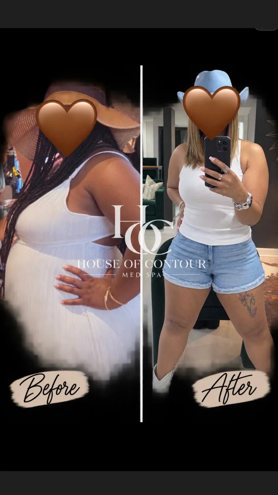 House of Contour client before-and-after comparison 1