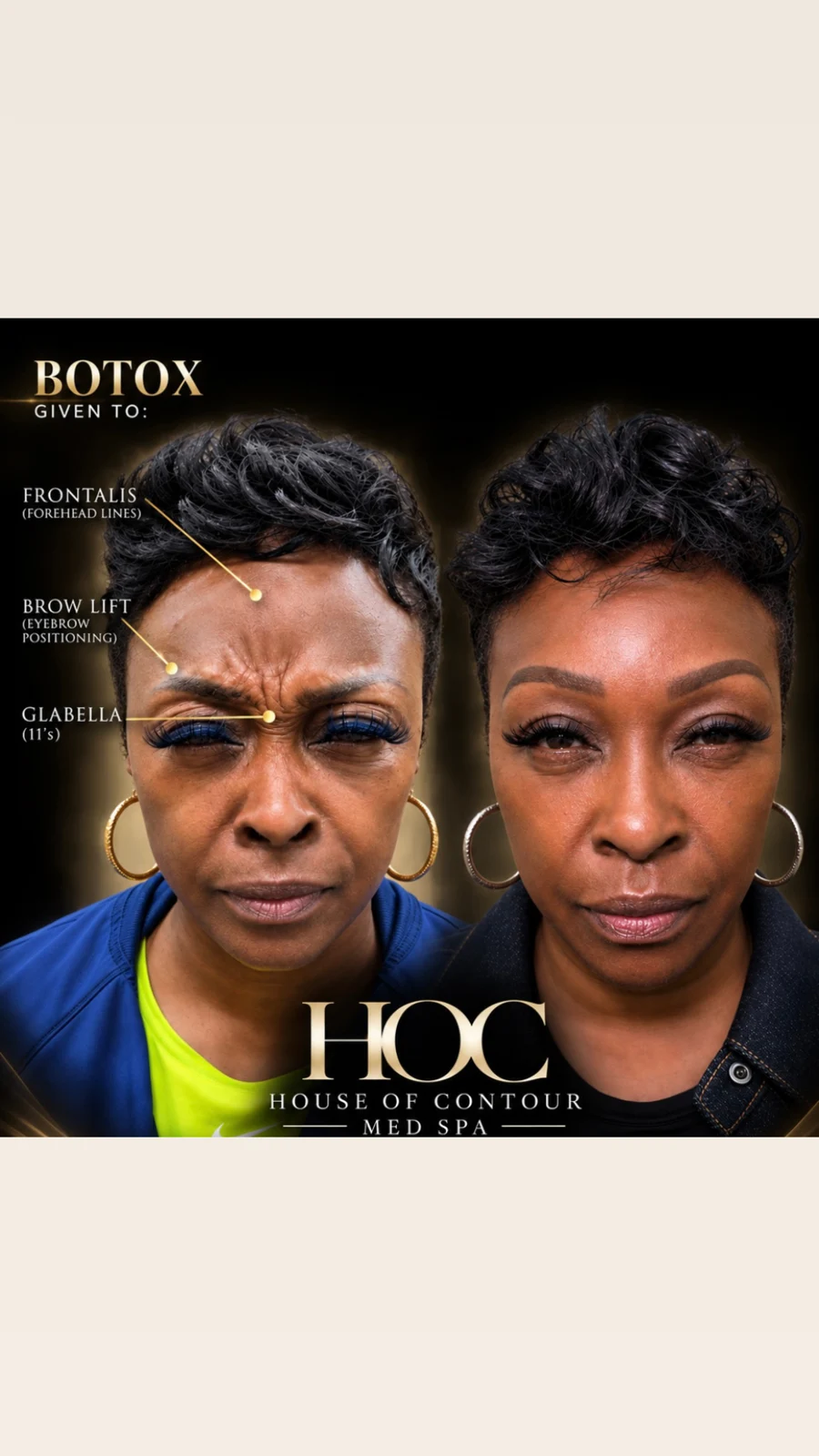 House of Contour client before-and-after comparison 2