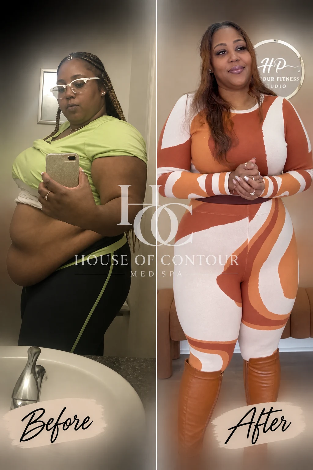 House of Contour client before-and-after comparison 3