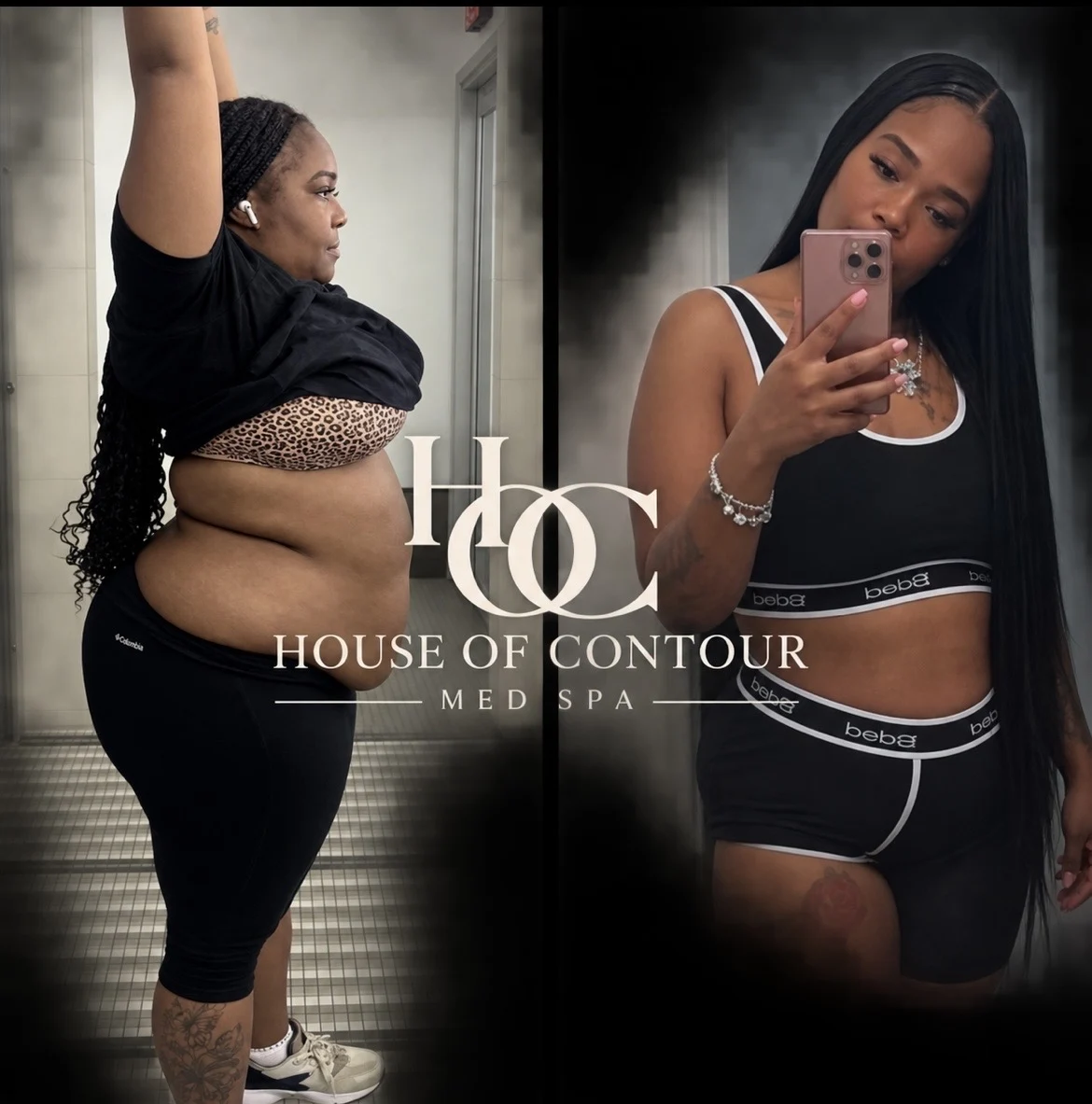 House of Contour client before-and-after comparison 4