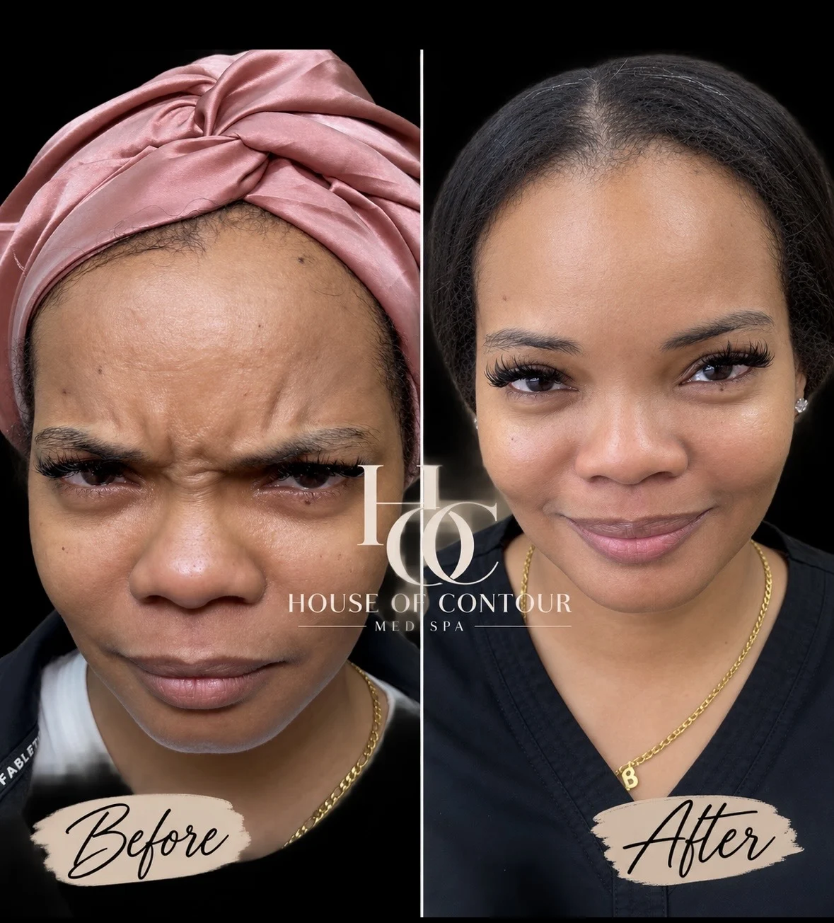 House of Contour client before-and-after comparison 5