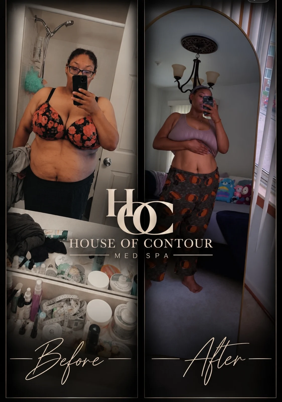 House of Contour client before-and-after comparison 6
