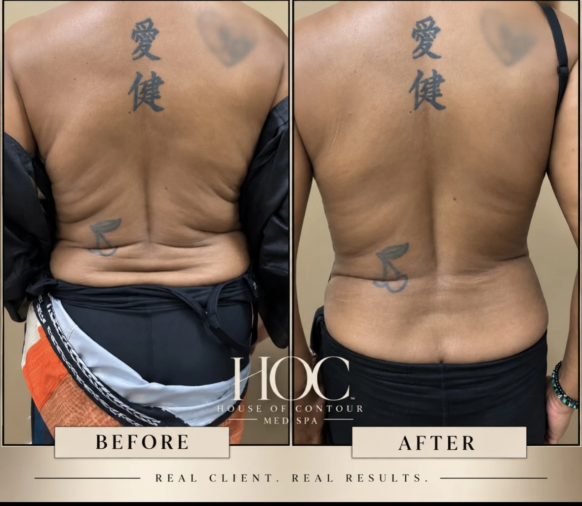 House of Contour client before-and-after comparison 7