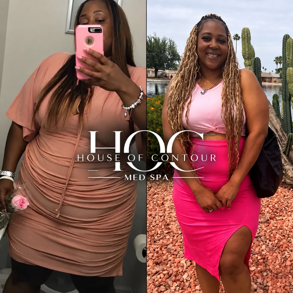 House of Contour client before-and-after comparison 8