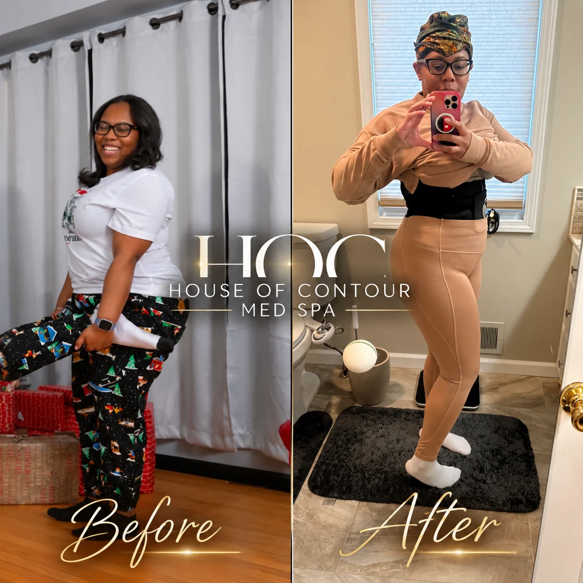 House of Contour client before-and-after comparison 10