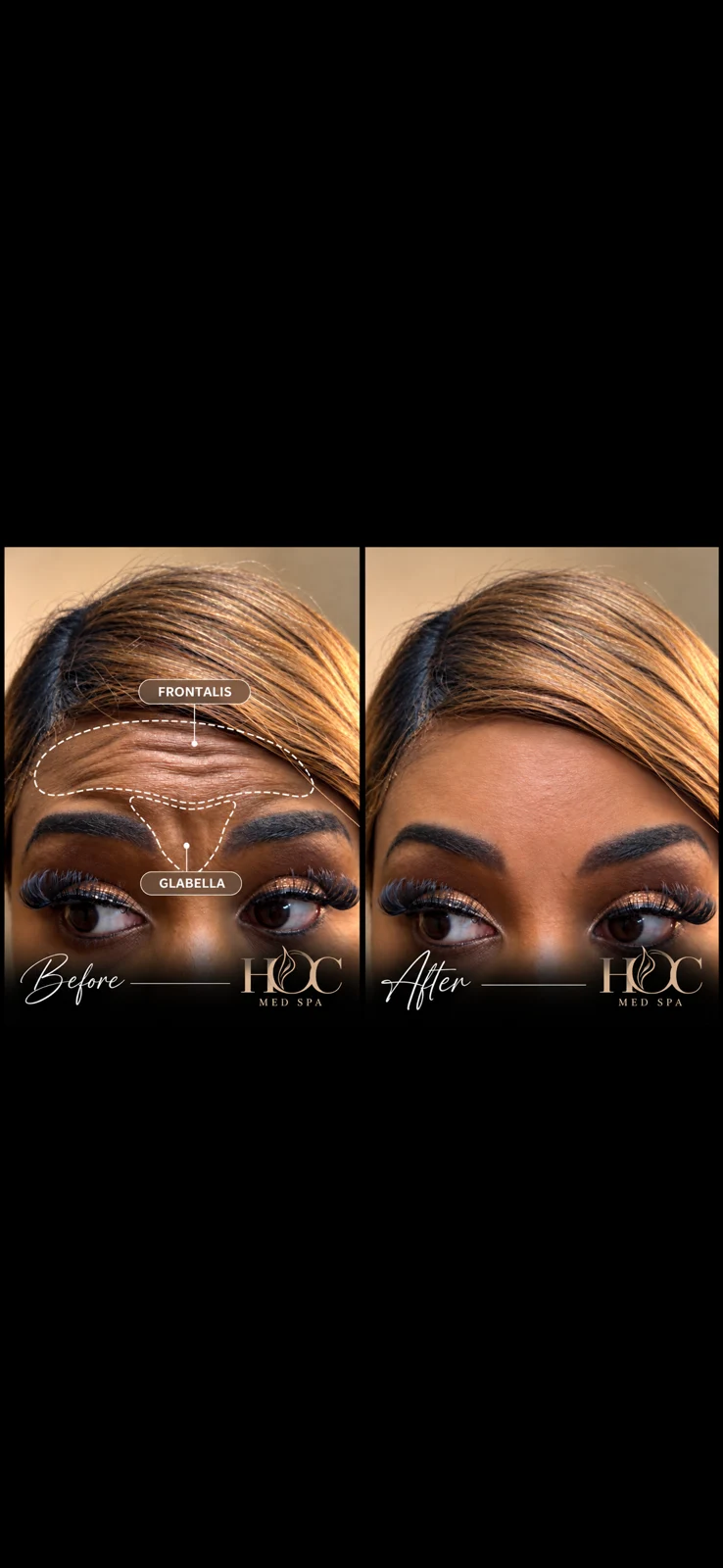 House of Contour client before-and-after comparison 11