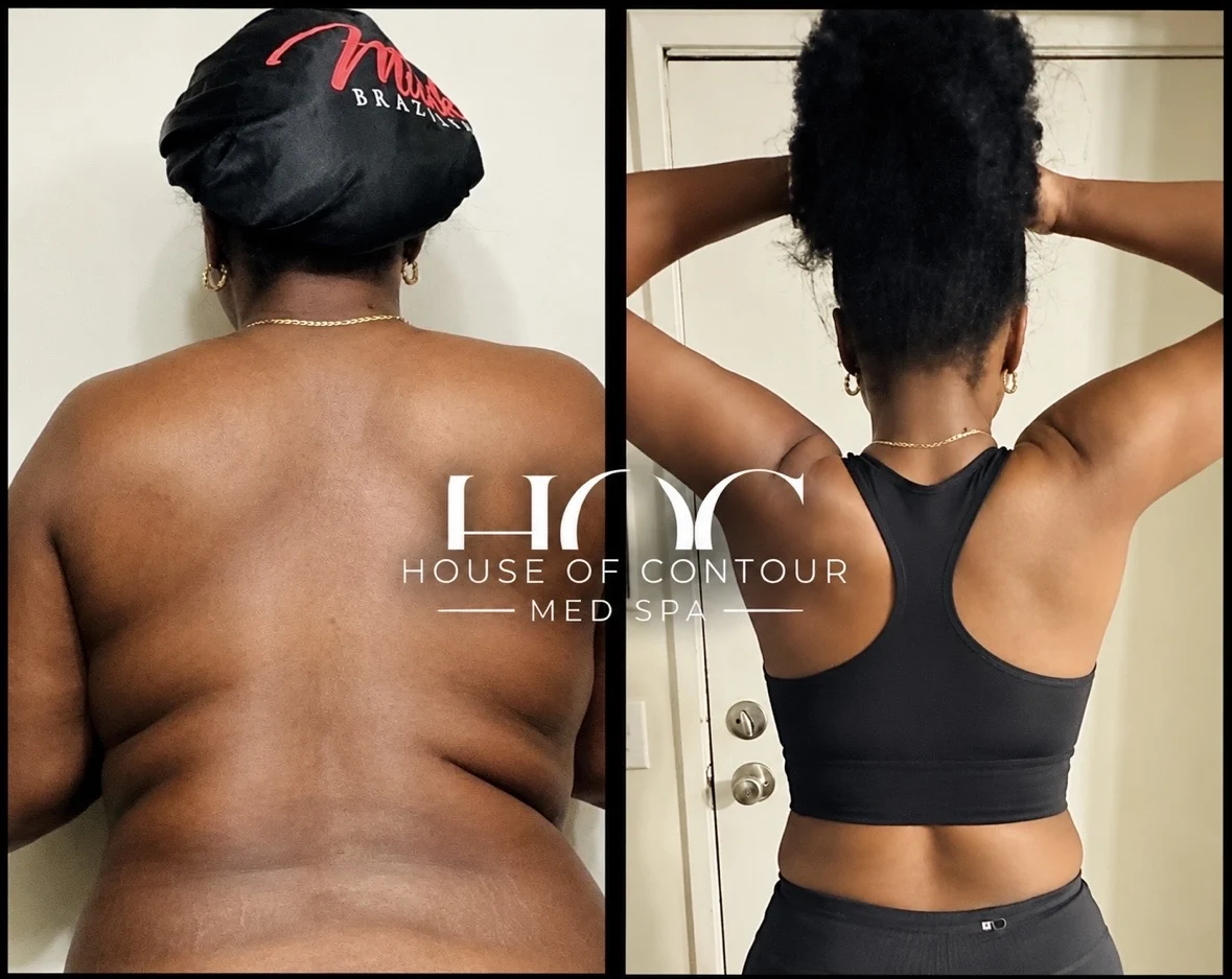House of Contour client before-and-after comparison 12