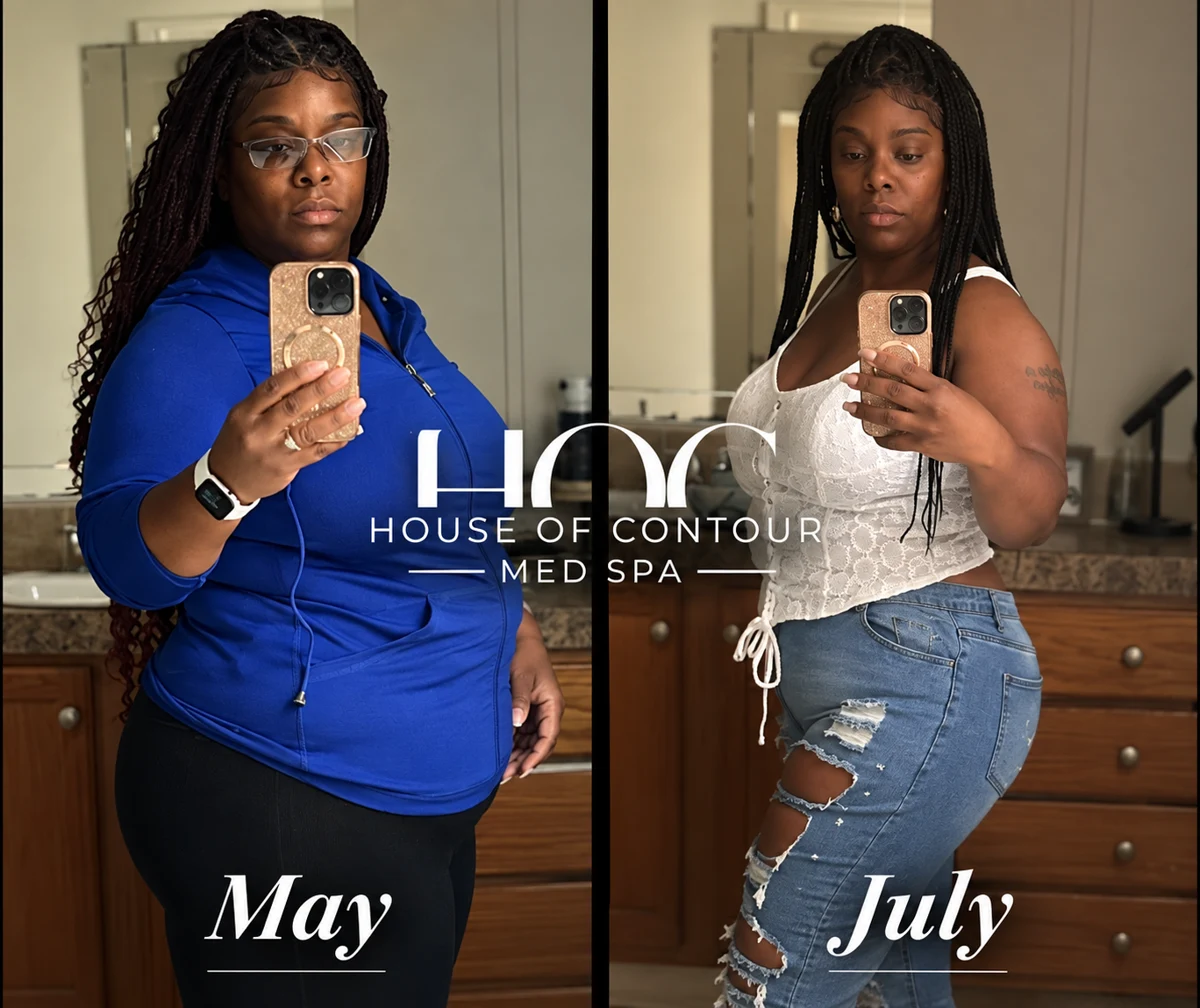 House of Contour client before-and-after comparison 13