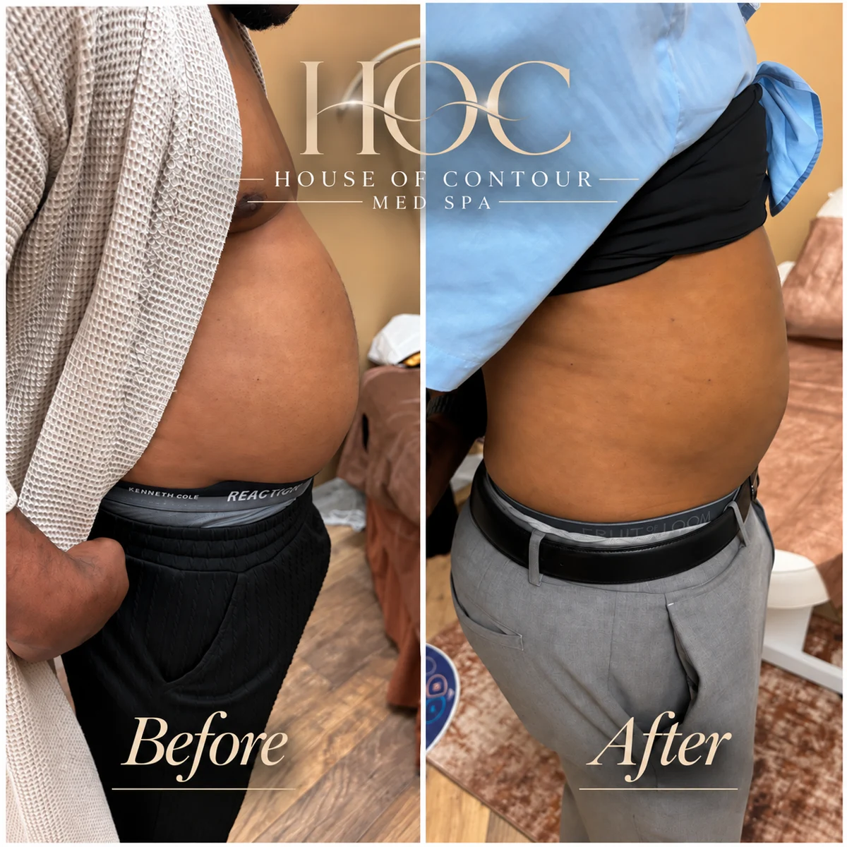 House of Contour client before-and-after comparison 14